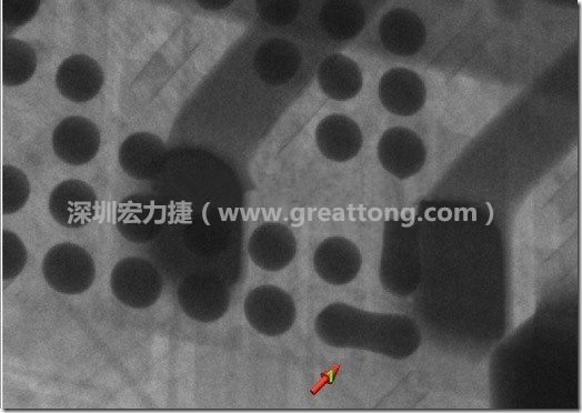 BGA因?yàn)楹笁|變小，造成錫膏過多而最終形成焊接短路的結(jié)果。